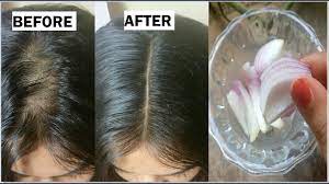The antioxidants, nutrients, vitamins e and k, and iron found in coconut oil helps enable both hair growth and regrowth. Onion Coconut Oil For Extreme Hair Growth In 30 Days To Get Long Hair Thick Hair Naturally Youtube