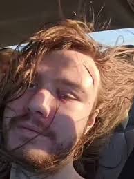 Chance Hogan's Instagram, Twitter & Facebook