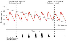 Your Blood Pressure Is 125 82 Is This Too High Athletic