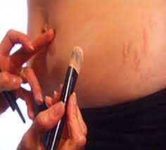 How To Cover Up Stretch Marks With Makeup Makeup Tips Stretch Marks Mark Makeup