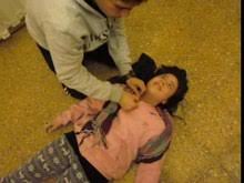 Boala se caracterizeaza prin convulsii recurente, care sunt episoade scurte de miscare involuntara care pot implica o parte a corpului. Epilepsie Wikipedia