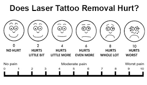 The pain chart for tattoos is there to let you know where to get your tattoo to avoid the most pain. Does Laser Tattoo Removal Hurt Understanding Tattoo Removal Pain Renude Laser