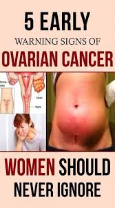 Ovarian cancer is often called the silent killer because it's hard to diagnose early. Pin On Hard Skin Lump On Leg