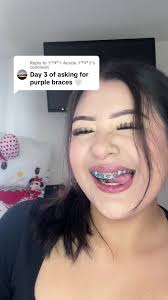 Light Purple Rubber Braces