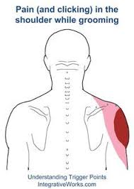Pin On Rotator Cuff