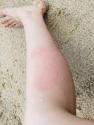 夏の終わりは要注意！クラゲだけじゃない、海を浮遊する「チンクイ」対策 | 海・川・カヌー・釣り  【BE-PAL】キャンプ、アウトドア、自然派生活の情報源ビーパル