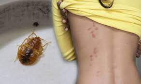 How do i know if it is bed bugs or other bugs? Bed Bugs Signs You May Have Been Bitten And How To Get Rid Of An Infestation Express Co Uk
