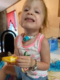 Hello i have an amt mini one balloon j tube. I want to remove it for good.  Does it jees to be sewed shut or does it close