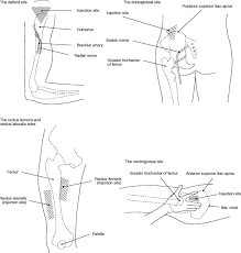 Image result for Intramuscular Injection