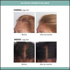 If you're taking biosil to get thicker, stronger hair, the side benefit would be reduced wrinkles and better bones. Biosil By Natural Factors Hair Skin Nails Supports Healthy Growth And Strength Vegan Collagen Elastin And Keratin Generator 120 Capsules Pricepulse