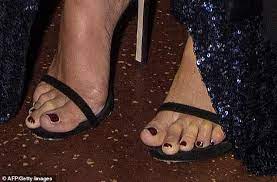 Meghan Markle Shows Off Dark Toenail Polish And Rumored Bunion Scar Meghan Markle Toenail Polish Meghan Markle Shows