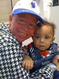 Ichthyosis Awareness Month: Diana's story ~ “I tell my daughter what being  a great friend to someone really means.”