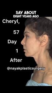 Sharon Savage Maxwell Surgery