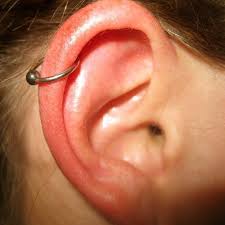 During that time, any bacteria (germs) that enter the wound can lead to infection. Complete Guide To Refer If A Piercing Gone Wrong