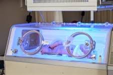 Check spelling or type a new query. Jaundice In Newborns Caring For Kids