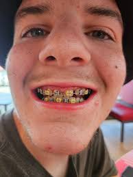 Curtis, the Junior Beekeeper (@CurtisTheJuniorBeekeeper) • Facebook