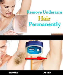 This makes hair removal less painful and easier. How To Remove Underarm Hair Permanently Is A Very Common Question Between Women And Men Actually It In 2020 Underarm Hair Removal Vaseline For Hair Underarm Hair