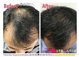 The fabulous hair straightening brush has well and truly landed and is becoming immensely popular! The 4 Best Laser Combs For Hair Growth 2021 Reviews