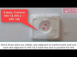 Hiv Hiv Test On Positive Person Hiv Tridot Test Elisa Technique Hiv Negative Hiv Results Youtube