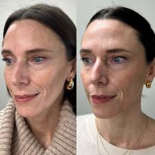 Skin Care & Aesthetics Clinic in York