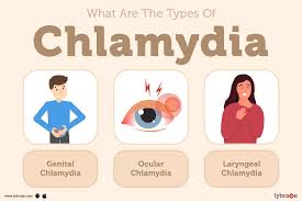 Image result for chlamydia symptoms
