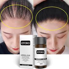 Keep the oil on for few hours and then wash with warm water. Buy Online Powerful Serum For Hair Growth Prevents Hair Loss Thicker Essential Oil To Prevent Hair Growth Anti Hair Loss Serum Tslm1 Alitools