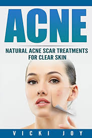Before you can treat the remnants of a blemish, it's important to know the difference there are dark spots, and there are real acne scars. Acne Natural Acne Scar Treatments For Clear Skin Clear Skin Clear Skin Diet Acne Scar Treatment Acne Treatment Acne Scars How To Get Rid Of Pimples Dermatology Kindle Edition By Joy
