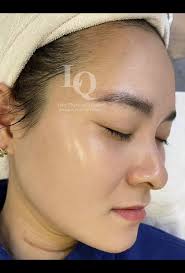 Chăm sóc da mặt hiệu quả với Le Quỳnh