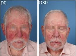 Journal of Investigative Dermatology