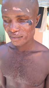 Ebriama camara an immigrant from Freetown, legally residing in the Gambia,  doing his work, was hit by a careless driver