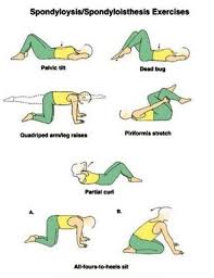 Lumbar Spondlyloysis Exercises Physical Therapy Exercises Physical Therapy Physical Therapy Assistant