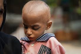 Pakistan's children are feeling the human toll of climate change: stunted  growth and school dropouts