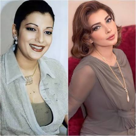 الفنانة #اصالة صاحبة الـ 53 عام قبل التجميـل و بعده 🤎 يذكر انها أثــارت  الـجـدل بعد اجرائها "بعض عمـلية تجميل" بدت فيها اصغر من عمرها في ملامح  مختلفة تماماً