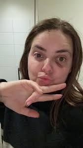 I got kicked in the head and people fell