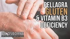 Often times referred to as the gluten free warrior. Peter Osborne Youtube