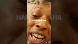 World news in pictures 6 september 2020. Xxxtention Fucked Up Free Music Download