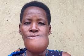 Fundraiser by Rachel Kinney : Medical Bills,Maxillofacial Surgery