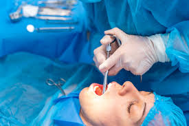 Tooth Removal Calgary | South Calgary Oral Surgery