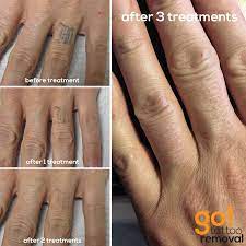 This Tattoo Wasn T In Super Solid And Had Significant Wear On It Already And The Client No Longer Wanted It After Hand Tattoos For Guys Hand Tattoos Tattoos