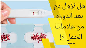 Check spelling or type a new query. Ø§ÙØ±Ø§Ø²Ø§Øª Ø§Ù„Ø­Ù…Ù„ Ù‚Ø¨Ù„ Ø§Ù„Ø¯ÙˆØ±Ù‡ Ø¨Ø®Ù…Ø³ Ø§ÙŠØ§Ù… Ø¹Ù„Ø§Ù…Ø§Øª Ø§Ù„Ø­Ù…Ù„ Ø§Ù„Ø£ÙƒÙŠØ¯Ø© Ù‚Ø¨Ù„ Ø§Ù„Ø¯ÙˆØ±Ø© Ø¨Ø®Ù…Ø³Ø© Ø£ÙŠØ§Ù… Youtube