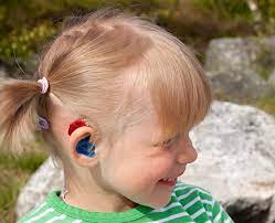 Supporting Success For Children With Hearing Loss Understanding How Well Your Child Hears With Hearing Aids