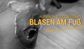 Blasen Aufstechen Ja Oder Nein Treat Of Freedom Nicht Nur Traumen Sondern Erleben