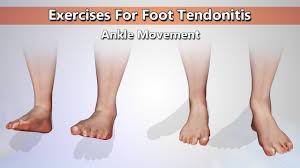 This mnt knowledge center article explains all about extensor tendons and what causes extensor tendonitis, including the symptoms and how is it. Top 7 Exercises For Foot Tendonitis