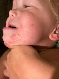 What could be causing this rash