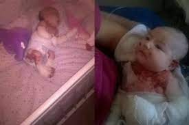 Pedido Solidario Su Beba Tiene Piel De Cristal Y No Pueden Pagar El Tratamiento Noticias Elentrerios Com