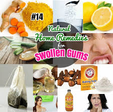 14 Best Home Remedies For Gingivitis Swollen Gums Easy Natural Home Remedies To Treat Sore Gums At Home Swollen Gum Gingivitis Remedies Natural Home Remedies