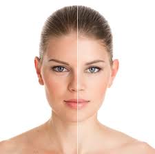 Check spelling or type a new query. What Is Skin Rejuvenation And How Does It Work The Dermatology Center Of Indiana