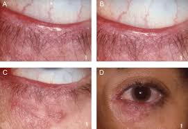 Image result for Blepharis bainesii