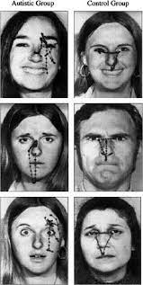 Autism is not being socially awkward. Autism And The Development Of Face Processing Sciencedirect