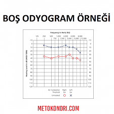 Check spelling or type a new query. Odyometri Klinik Arsivi Ve Odyoloji Arsivi Metokondri